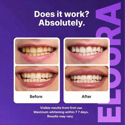Vibeify Purple Teeth Whitening Strips