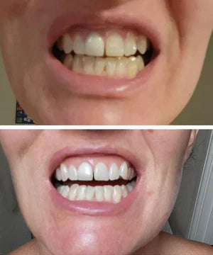 Vibeify Purple Teeth Whitening Strips